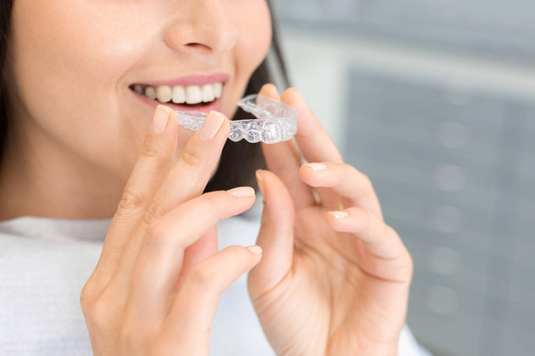 invisalign-price-dcard