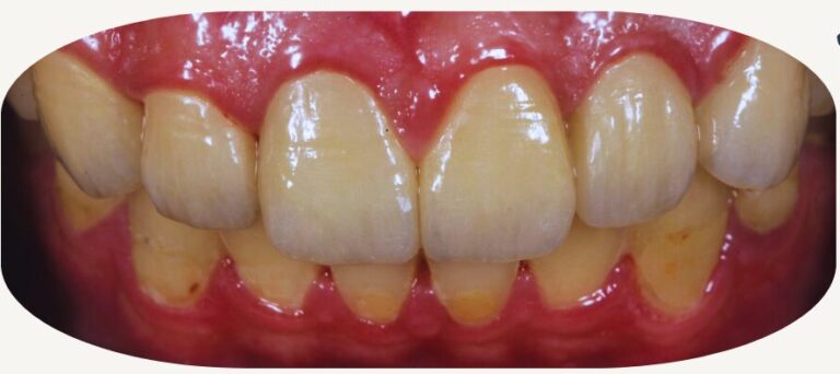 artsdental 1 1 1 e1721381865627