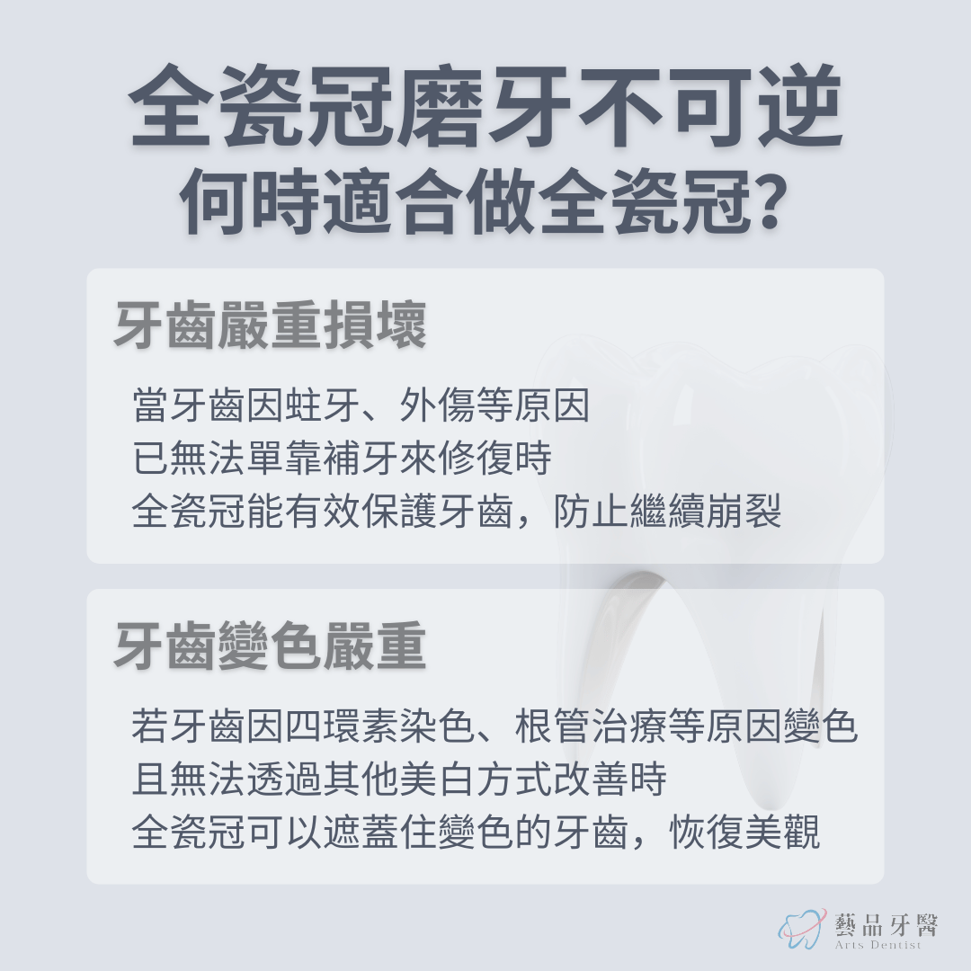 全瓷冠磨牙不可逆，牙齒美白也須謹慎